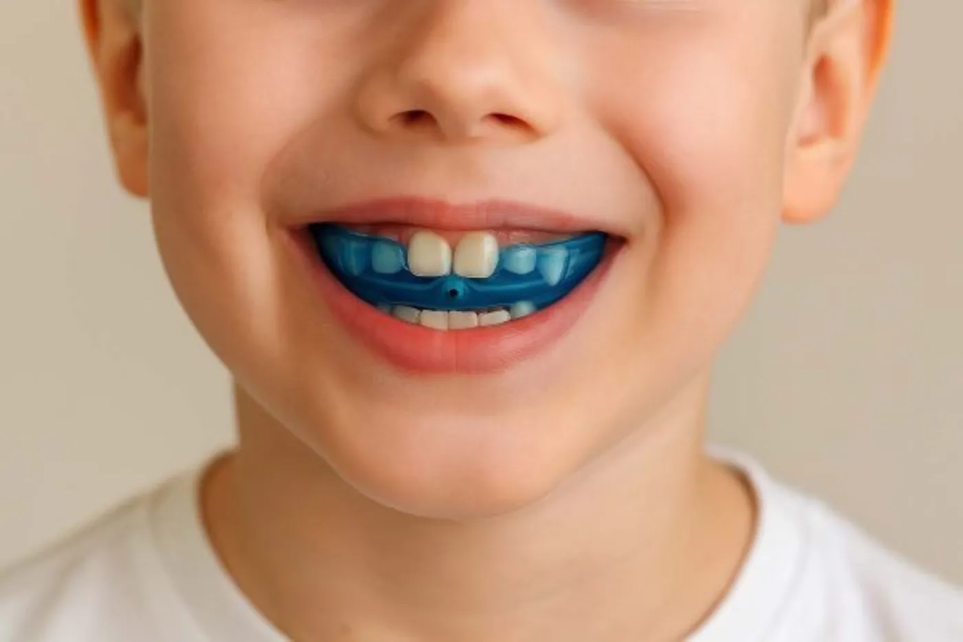 Myobrace aparat za decu 600x400